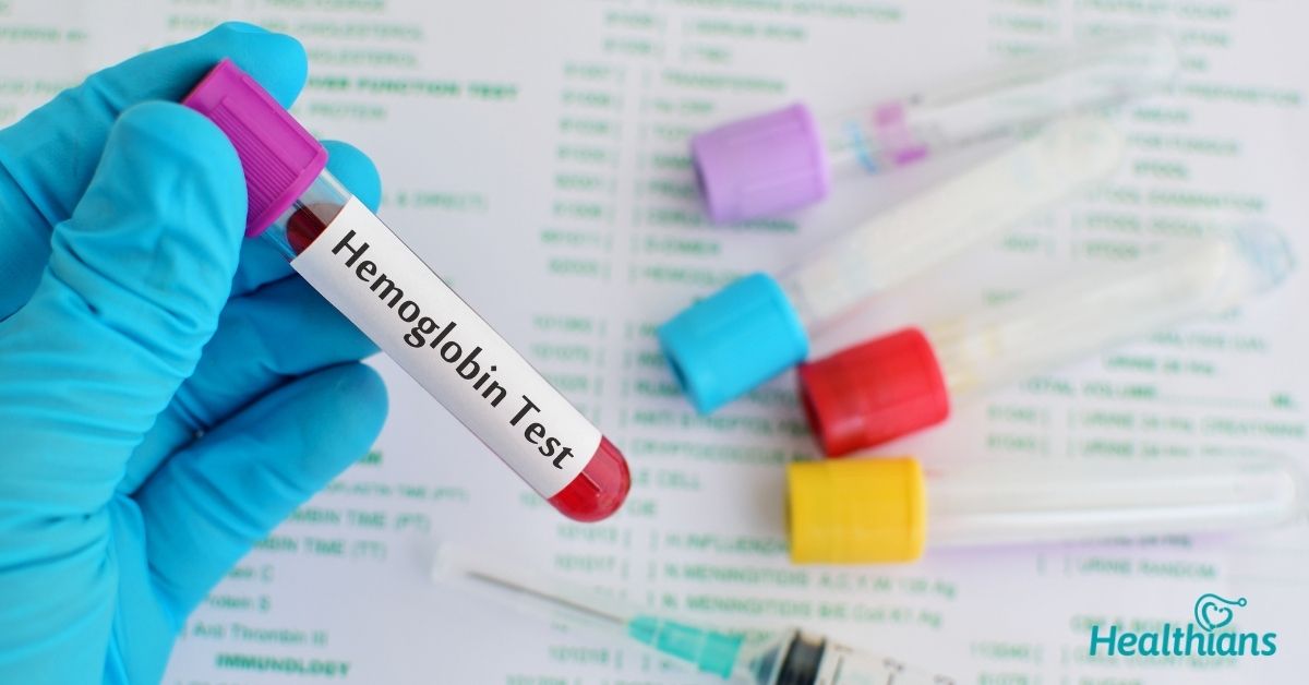 Hemoglobin Blood test